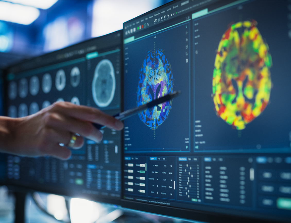 Spark-Digitial-The-Florey-2 Spark Digital - The Florey case study: Brain imaging on a screen.
